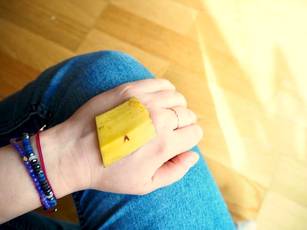 Bananenschalen gegen Mückenstiche